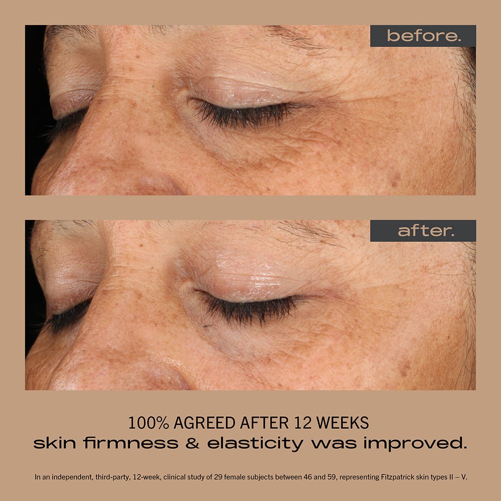 Best stable vitamin c serum for sensitive skin HK 亮白去斑精華
