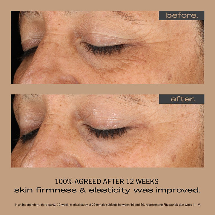 Best stable vitamin c serum for sensitive skin HK 亮白去斑精華