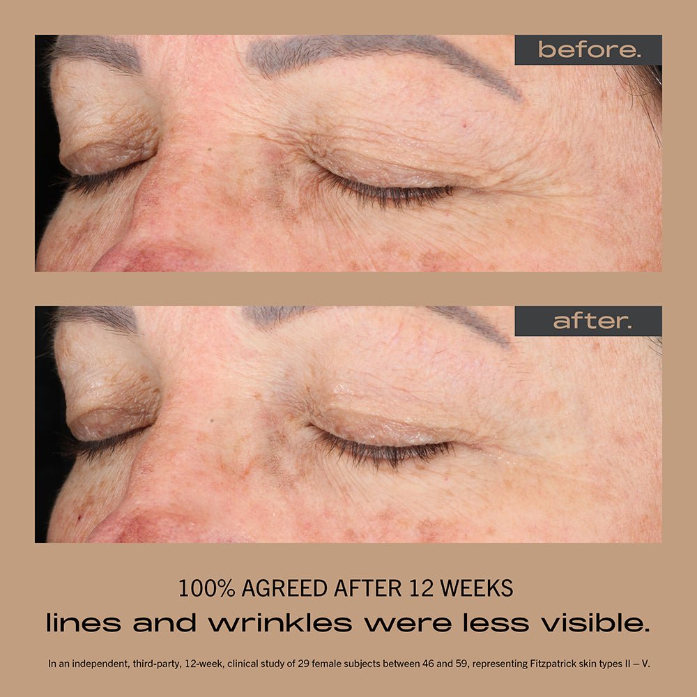 Best stable vitamin c serum for sensitive skin HK 亮白去斑精華