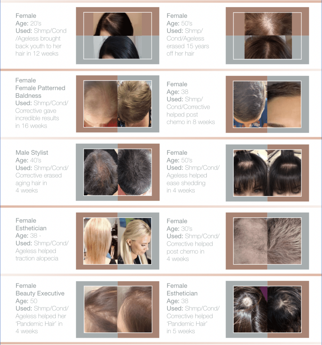 Ethica Corrective Serum for receding hairline and DHT blocking 男士生髮水 - Clove Beauty