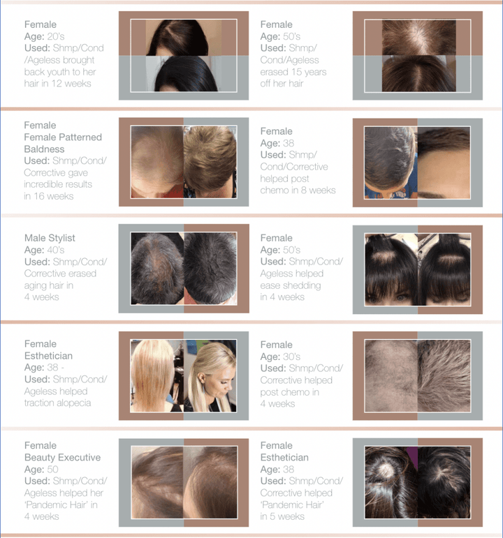 Ethica Corrective Serum for receding hairline and DHT blocking 男士生髮水 - Clove Beauty