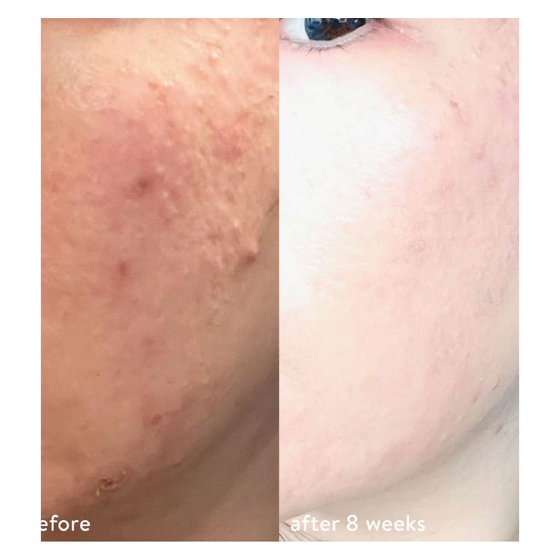 Oxygen Serum + HOCL 皮膚修復精華