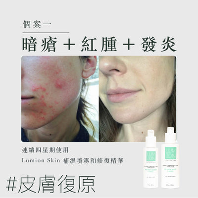 Oxygen Mist + HOCL 消毒補濕噴霧