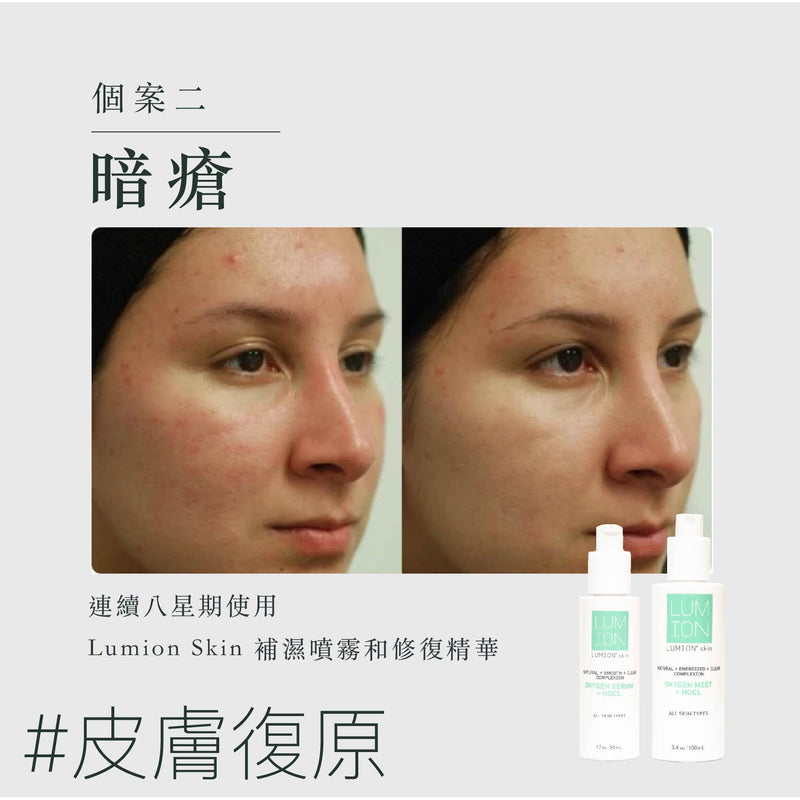 Oxygen Mist + HOCL 消毒補濕噴霧