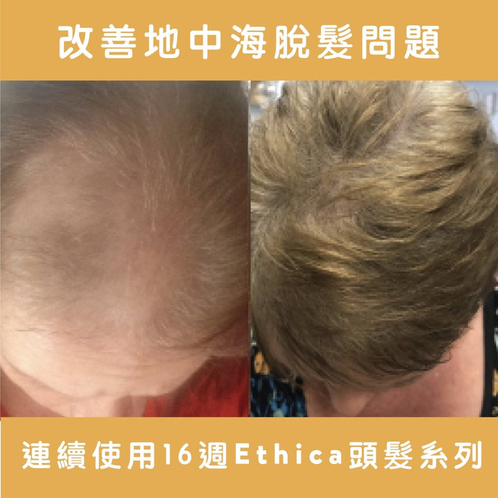 Ethica Corrective Set hair growth kit for men and women M字額救星 - Clove Beauty