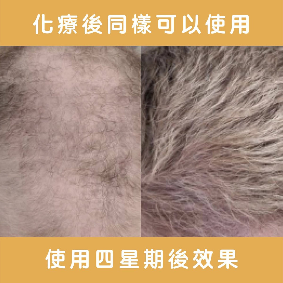 Ethica Corrective Set hair growth kit for men and women M字額救星 - Clove Beauty