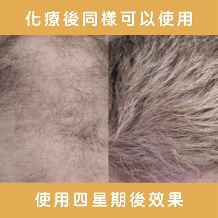 Ethica Corrective Set hair growth kit for men and women M字額救星 - Clove Beauty