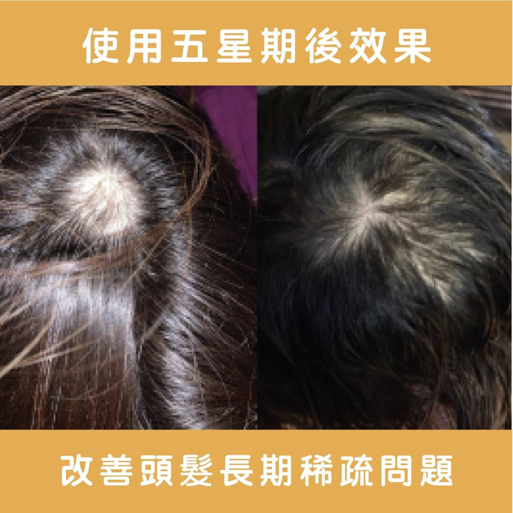Ethica Corrective Set hair growth kit for men and women M字額救星 - Clove Beauty